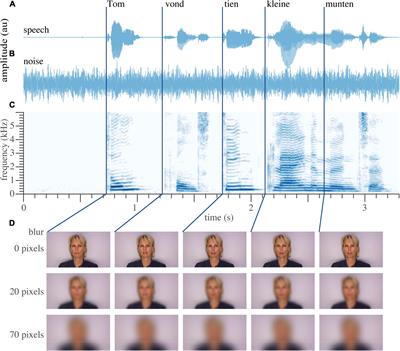 Multisensory Integration-Attention Trade-Off in Cochlear-Implanted Deaf Individuals